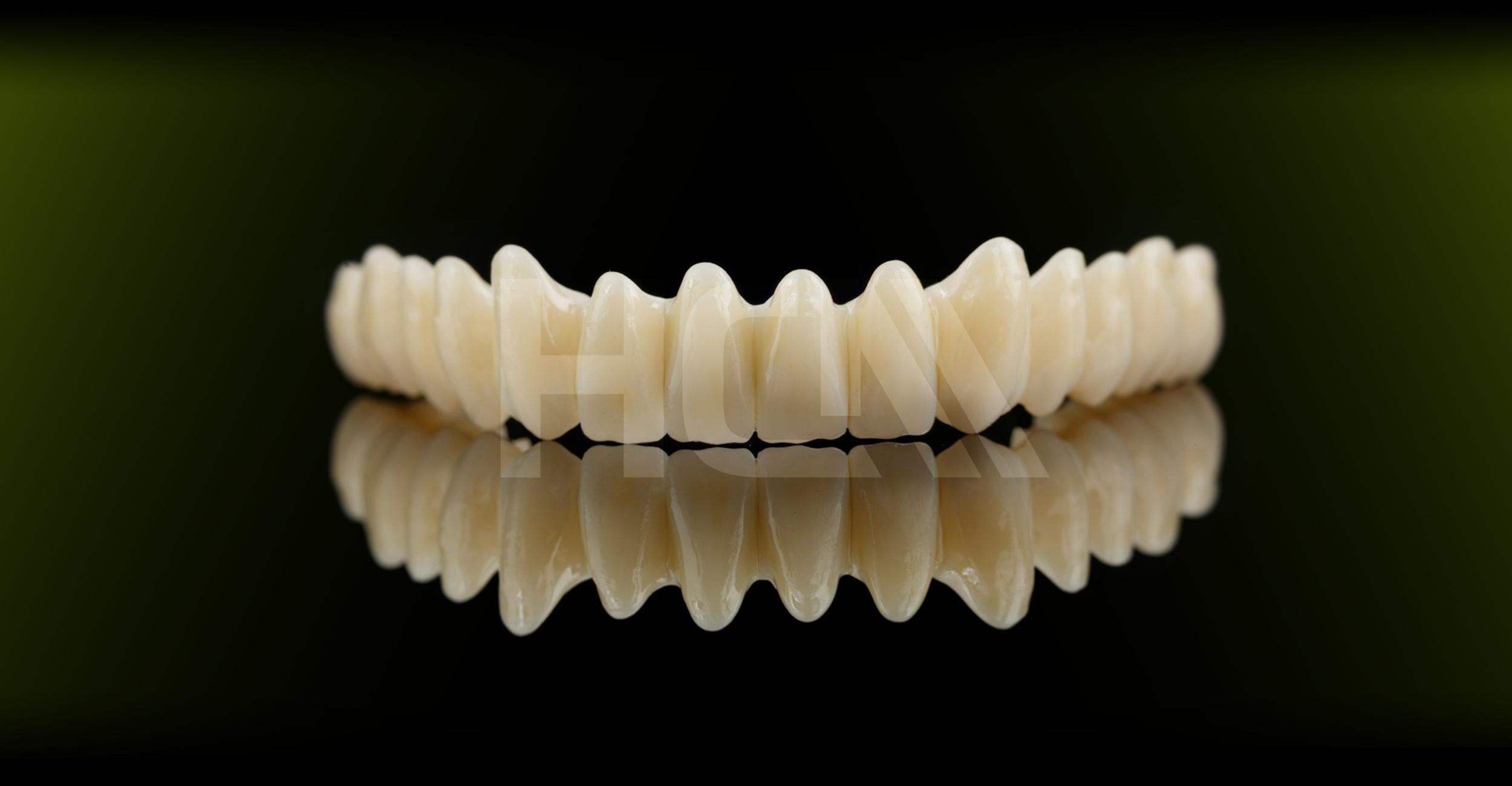 Cemented or screw retained crowns